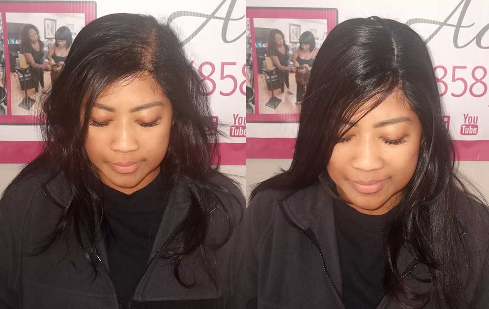 hair loss remediation example